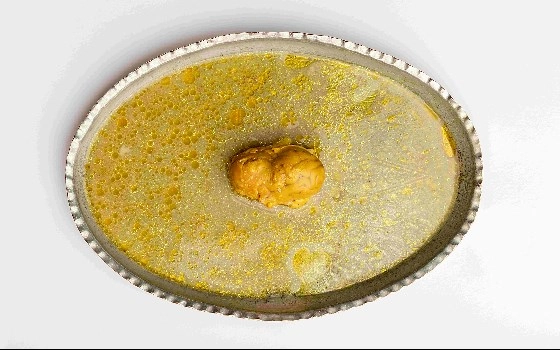 نصفه مغز